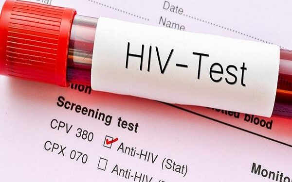 Ghana detects 34,000 new HIV infections within nine months of 2024.