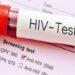 Ghana detects 34,000 new HIV infections within nine months of 2024.