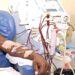 ‘Free dialysis is a lifeline, but why now?’ – Dr Sarpong Asiedu questions NHIS rollout.