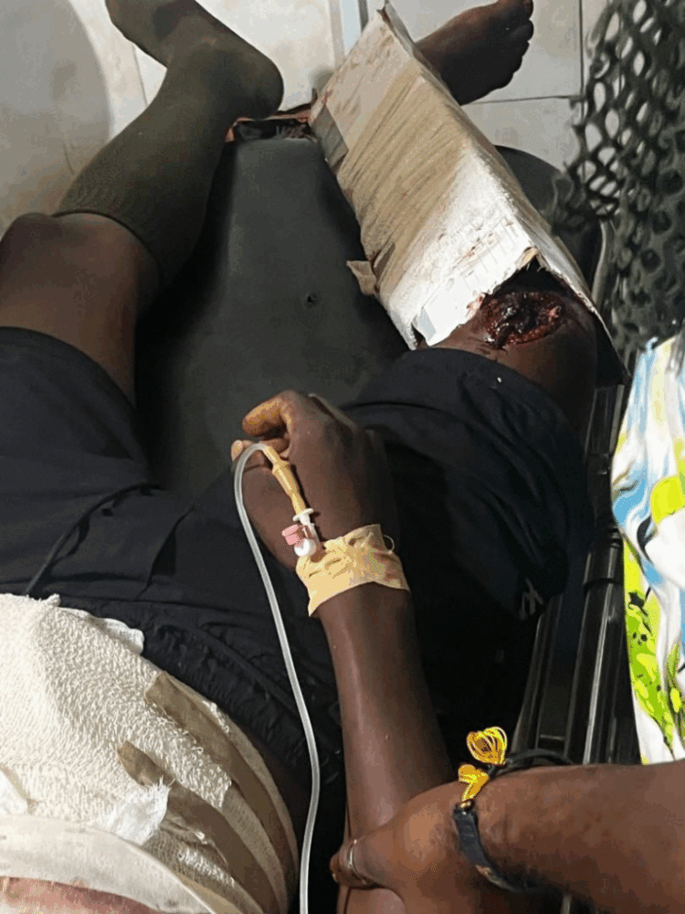 Two immigration officers ambushed and shot in Upper East Region’s Tempane district