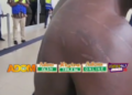 ‘Look at my marks’ – Evacuated Ghanaian alleges xenophobic beating in South Africa