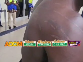 ‘Look at my marks’ – Evacuated Ghanaian alleges xenophobic beating in South Africa