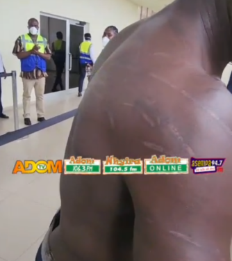 ‘Look at my marks’ – Evacuated Ghanaian alleges xenophobic beating in South Africa