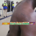 ‘Look at my marks’ – Evacuated Ghanaian alleges xenophobic beating in South Africa